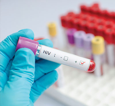 Preliminary Findings from HPTN 078 Indicate High Levels of HIV and Syphilis in MSM and TGW